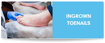 ingrown toenails in charlotte nc